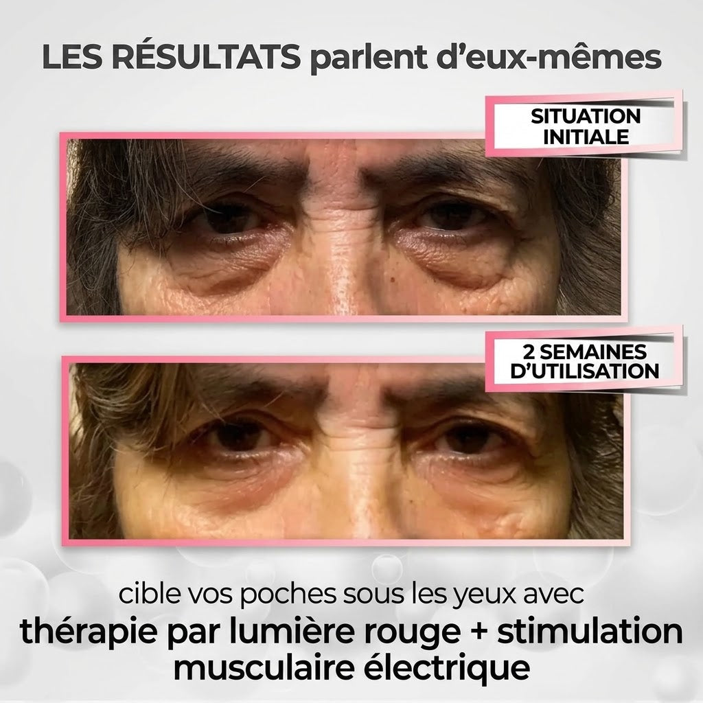 Lumina Paris — Appareil contour des yeux LED 630 nm + micro-courants EMS
