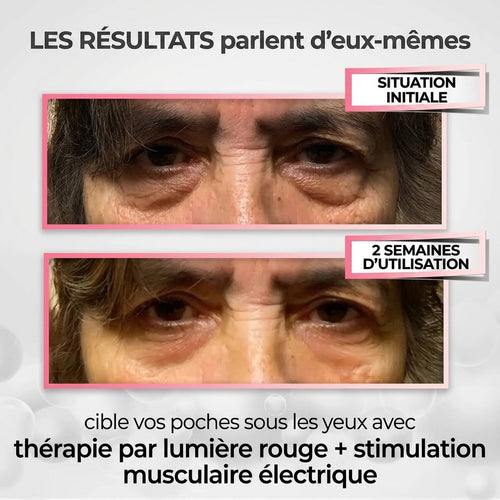 Lumina Paris — Appareil contour des yeux LED 630 nm + micro-courants EMS